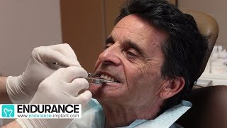 Prothèse amovible  Travail du dentiste et prothésiste  Dr SUBA Hongrie [upl. by Anivram305]