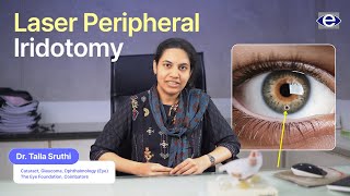 Laser Peripheral Iridotomy  Common Eye Conditions  The Eye Foundation eyecare eyecareservices [upl. by Eatnoed]