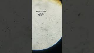 viralvideo semen analysis test in microscope slide viralreels viralshorts viralreels viralsong [upl. by Ella]