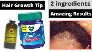 How to use Vicks vaporub for Faster Hair Growth [upl. by Ynaiffit221]