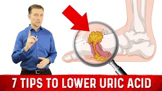 7 Tips to Lower Uric Acid – Dr Berg [upl. by Coucher]