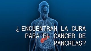 Como curar el cáncer de pancreas 10 formas [upl. by Harl]