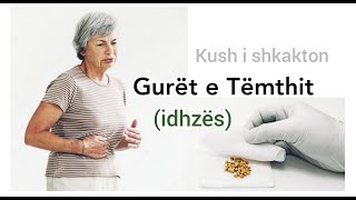 GURET NE TEMTH idhëz  Ushqimet qe nuk lejohen  Si sherohen guret e temthit  idhzes  Biliare [upl. by Aurel]