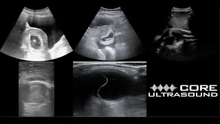 Core Ultrasound Image Review Episode 6 [upl. by Burkley]