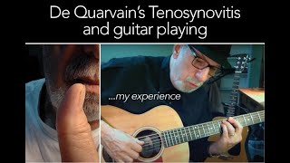 De Quarvains Tenosynovitis and Guitar Playing My Experience [upl. by Pickar]