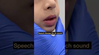 Speech Therapy  Articulation ch Sound  Tongue Positioning  Mis articulation  Teach Sound [upl. by Nelson]