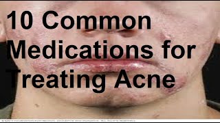 10 Common Medications for Treating Acne [upl. by Rozele]