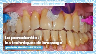 🦷 La parodontie  les différentes techniques de brossage avec le Dr Matthias RZEZNIK [upl. by Adaj99]