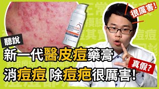 新一代醫皮痘 EPIDUO FORTE 藥膏，可以消痘痘、除痘疤，真假？皮膚科楊省三醫師幫你詳細分析醫皮痘複方凝膠，為何痘痘肌患者滿意度高！ [upl. by Adihsaar]