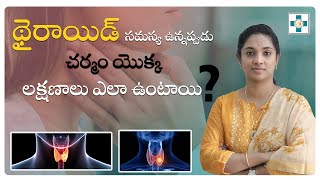 థైరాయిడ్ సమస్య ఉన్నప్పుడు చర్మం యొక్క లక్షణాలు ఎలా ఉంటాయి   How Thyroid affects your skin [upl. by Anairam]