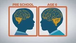 How baby brains develop [upl. by Daryl]