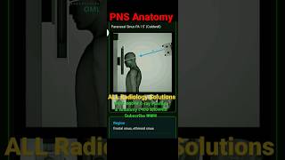 Xray of PNS Position amp Anatomy PNSpns [upl. by Gemperle]