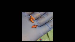 Root stumps Extraction dental dentalcare dentist satisfying dentalclinic [upl. by Airalednac780]