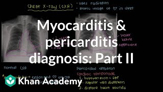 Diagnosis of myocarditis and pericarditis part 2  NCLEXRN  Khan Academy [upl. by Gallard46]