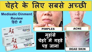 Medisalic Cream Review in hindi safe or unsafe Clobetasol propionate amp salicylic acid ointment [upl. by Inoliel]