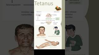 Tetanus Clostridiumtetani [upl. by Marva]