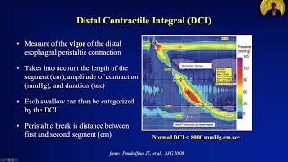 Manometry Report Interpretation Essentials Dos and Donts [upl. by Atinnod821]