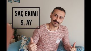 SAÇ EKİMİ 5 AY [upl. by Fabiano]