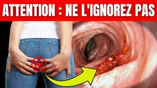 7 Symptômes URGENTS de Cancer du Côlon [upl. by Oiratno]