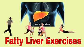 Fatty Liver Exercises [upl. by Tnattirb964]