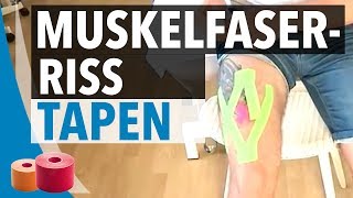 Muskelfaserriss Tapen Anleitung  Kinesiologie Tape Anleitung für Muskelfaserriss [upl. by Obel]