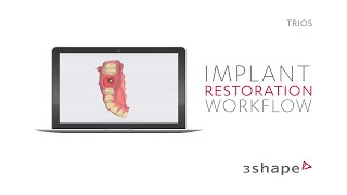 3Shape TRIOS  Implant restoration workflow [upl. by Dine]