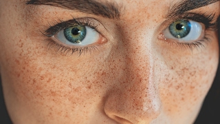 How to Create Stunning FRECKLES without Photoshop  Portrait Photography Tutorial [upl. by Ayama]