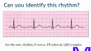 ECGEKG Electrocardiogram interpretation [upl. by Ackerley]