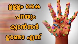 Cancer Symptoms Apear In Your Soul Of Hand  Oneindia Malayalam [upl. by Paehpos255]