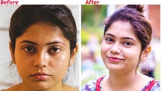 How To Remove Sun Tan Instantly  सन टेन कैसे हटायें  Skin Brightening home remedy 100 effective [upl. by Ewald]