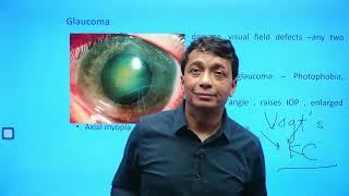 Ophthalmology  Rapid Revision  Part 2  Target FMGE 2024  Dr Saswat Ray720PHD [upl. by Eninnej]