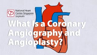 The lifesaving procedure you need to know about  Coronary Angiography [upl. by Synned]