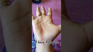 I have four fingers finger funny subscribe surprise [upl. by Chlori]