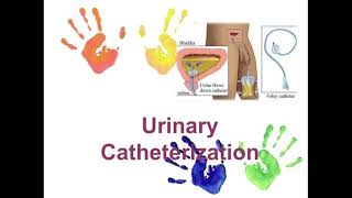 folyce catheter procedure [upl. by Tynan]