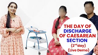 The Day of Discharge of Caesarean section Day 2   Live Demo  Dr Asha Gavade [upl. by Nnair26]