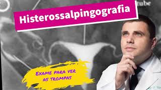 Histerossalpingografia  exame para ver as trompas [upl. by Ynahpets]