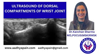 Ultrasound of the dorsal compartments of the wrist joint [upl. by Isborne]