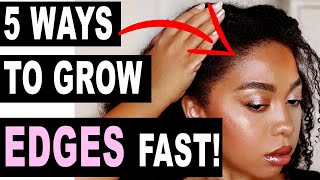 HOW TO GROW EDGES BACK FAST 5 SIMPLE TIPS TO GROW YOUR HAIRLINEEDGES BACK FAST [upl. by Osbert]