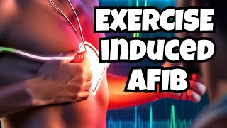 Exercise Induced AFib Expert Tips [upl. by Kcired]