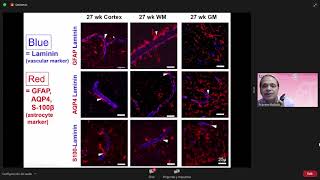 2 Germinal Matrix why the haemorrhage [upl. by Yssirk]