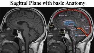 Introduction on MRI Brain PLANESSEQUENCES amp ANATOMY MRI Brain Imaging Techniques for beginners [upl. by Naimaj]