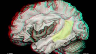 Fiber Pathways of the Cerebrum 3D Anaglyph [upl. by Ecnaralc669]