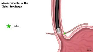 HCC 14751EsophagusAnatomy [upl. by Stew]