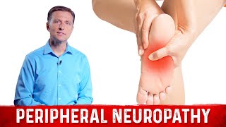 How to Relieve Peripheral Neuropathy Pain – Dr Berg [upl. by Aimahc]