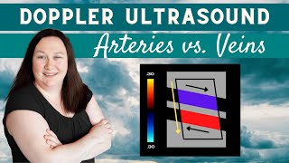 Doppler Ultrasound Arteries vs Veins [upl. by Yhtac306]