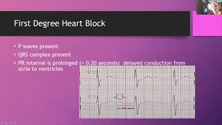 Heart Blocks [upl. by Ninnetta]