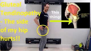 Gluteal tendinopathy  Why does the side of my hip hurt [upl. by Fulbert238]