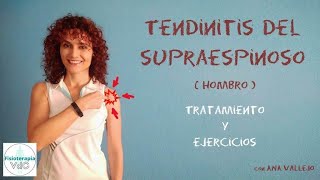 Tendinitis supraespinoso Tratamiento y ejercicios para mejorarlo [upl. by Zoara]