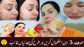 Freckles remove formula used just 2 ingredients and get fast amazing results mahajutt [upl. by Nohsyt]