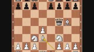 Chess Basics Queen Overview [upl. by Eekaz]